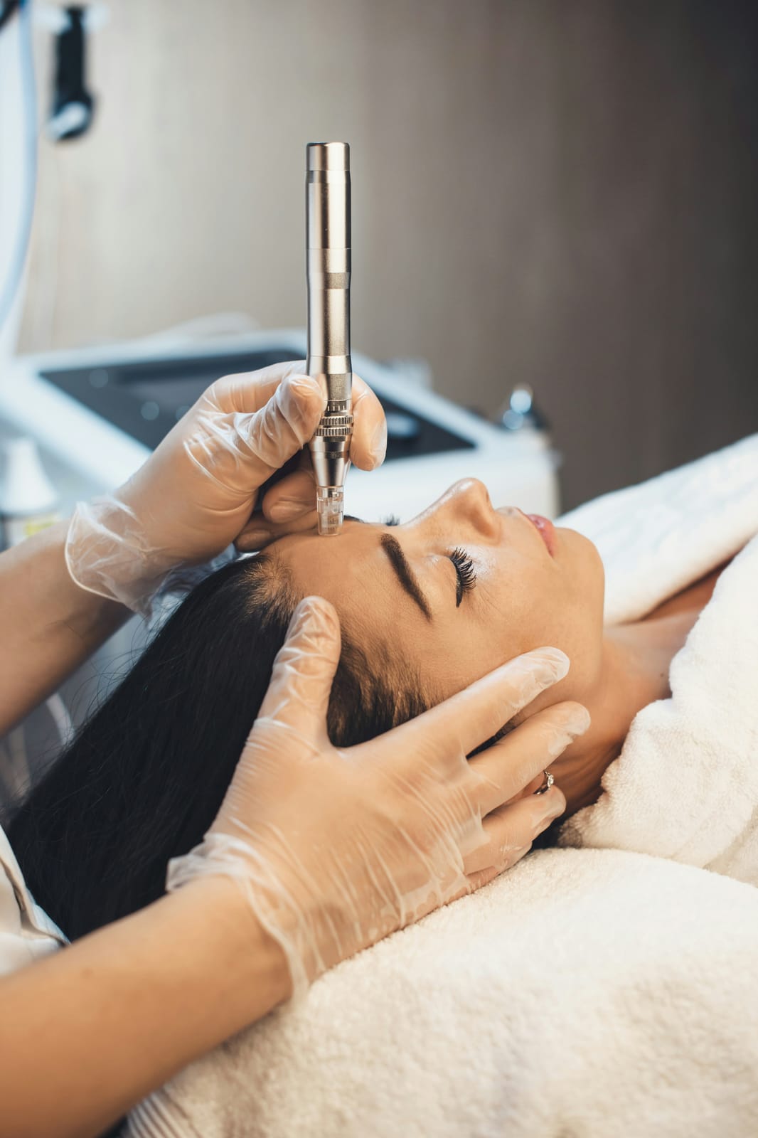 Mesoestetic m.pen microneedling hooldus